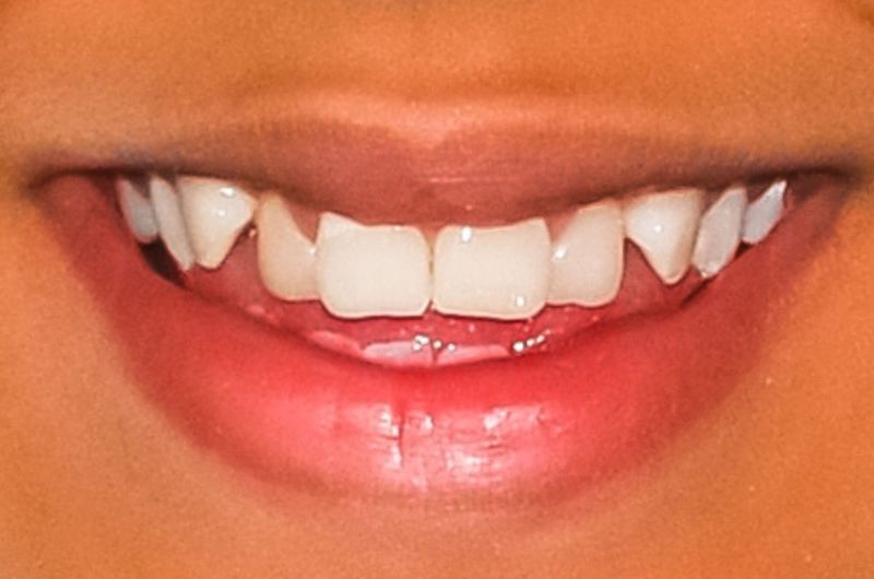 Before