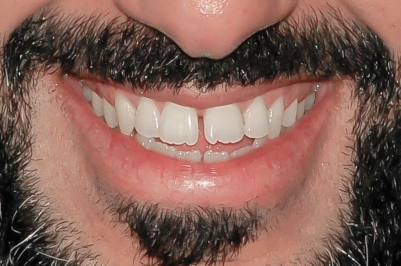 Before
