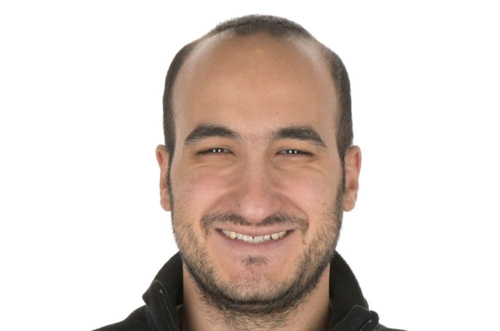 Ortho-Restorative Collaboration for Gap Correction_before