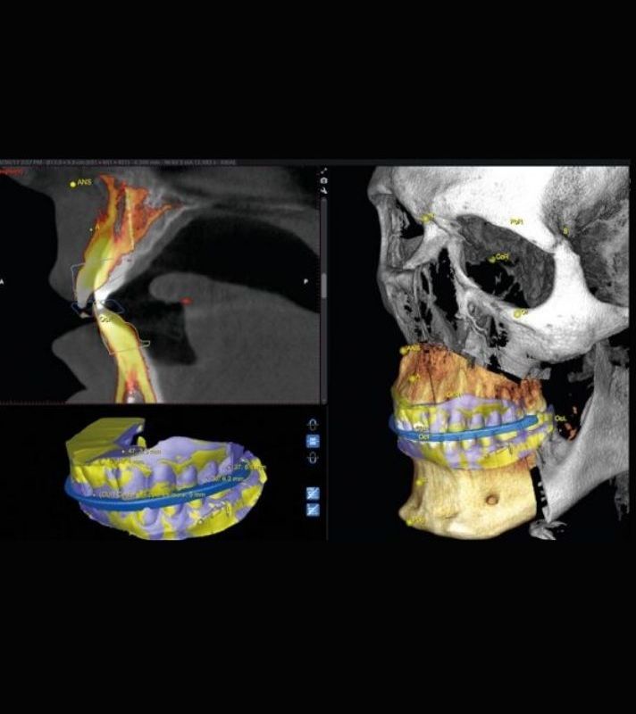 Our smiles case studies0